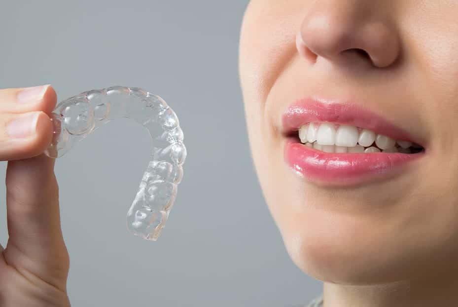 Cosmetic Invisible Braces Invisalign At Define Dental Clinic Beaconsfield
