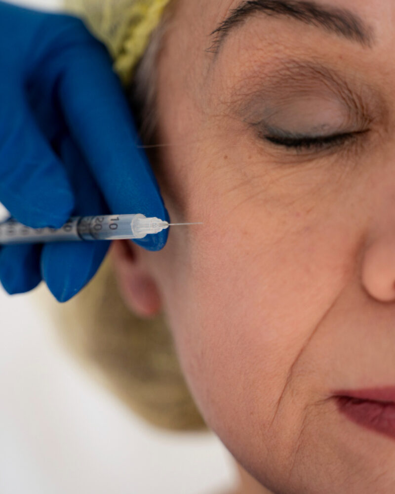 Facial Muscle Dynamics and Wrinkle Formation