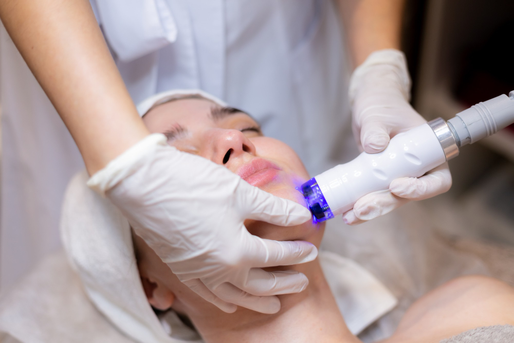 photorejuvenation london