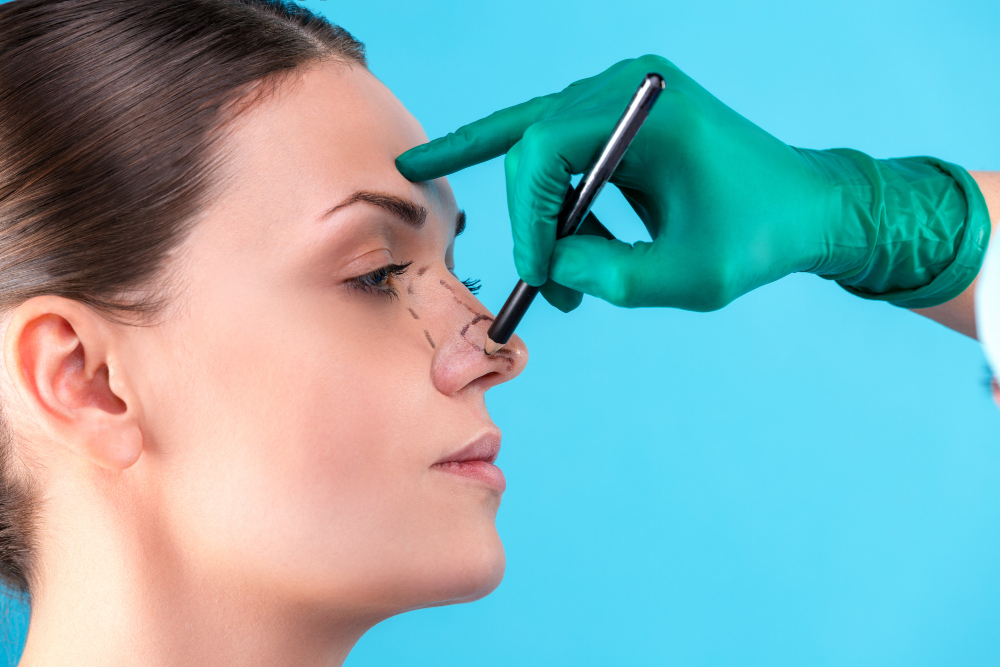 non surgical rhinoplasty london