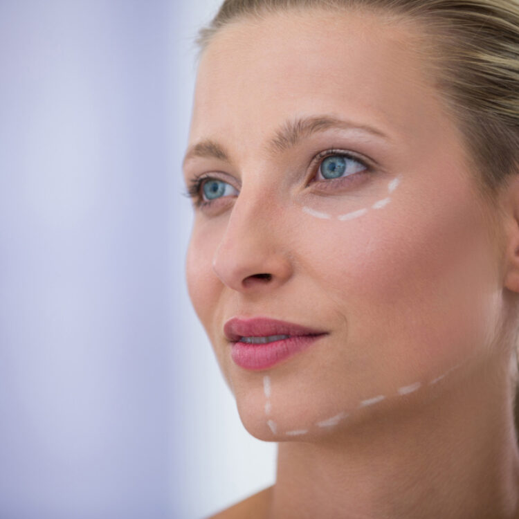 What Tear Trough Filler London Can & Can’t Do