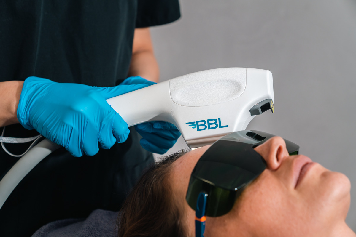 Laser Treatments In London