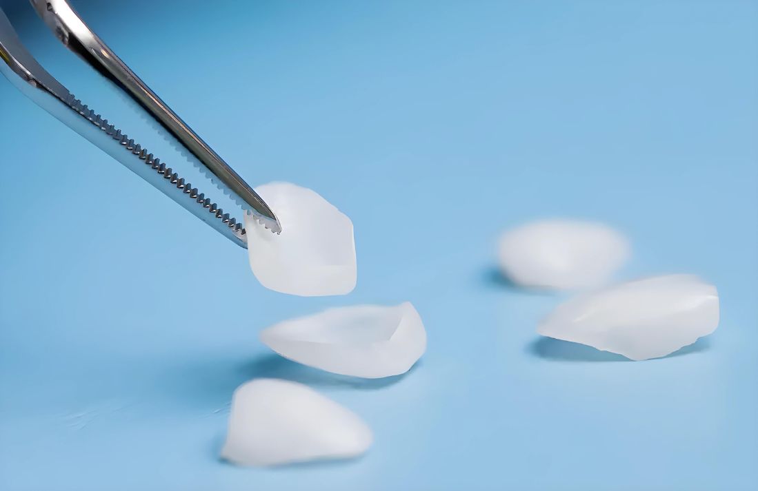 Define web images (2) Porcelain Veneers