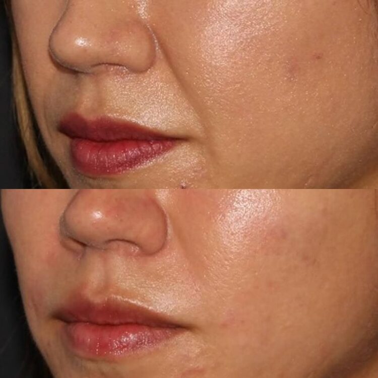 How to Read Before and After Photos