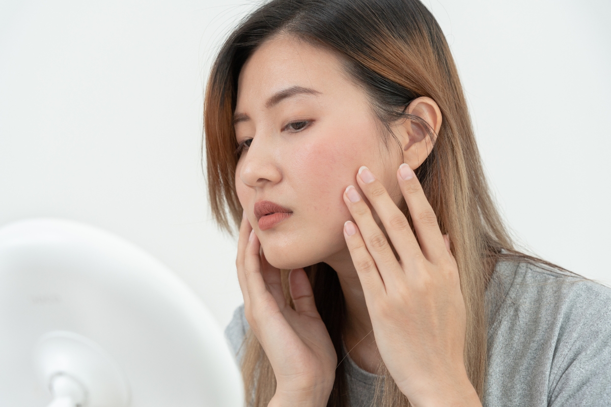 Facial Redness