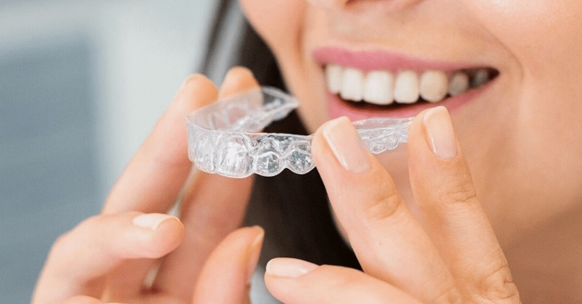 Misaligned-Teeth-1