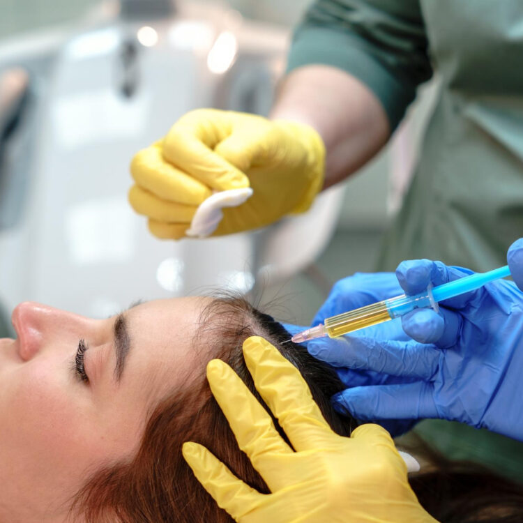 PRP in London explained: Is this treatment really worth the hype