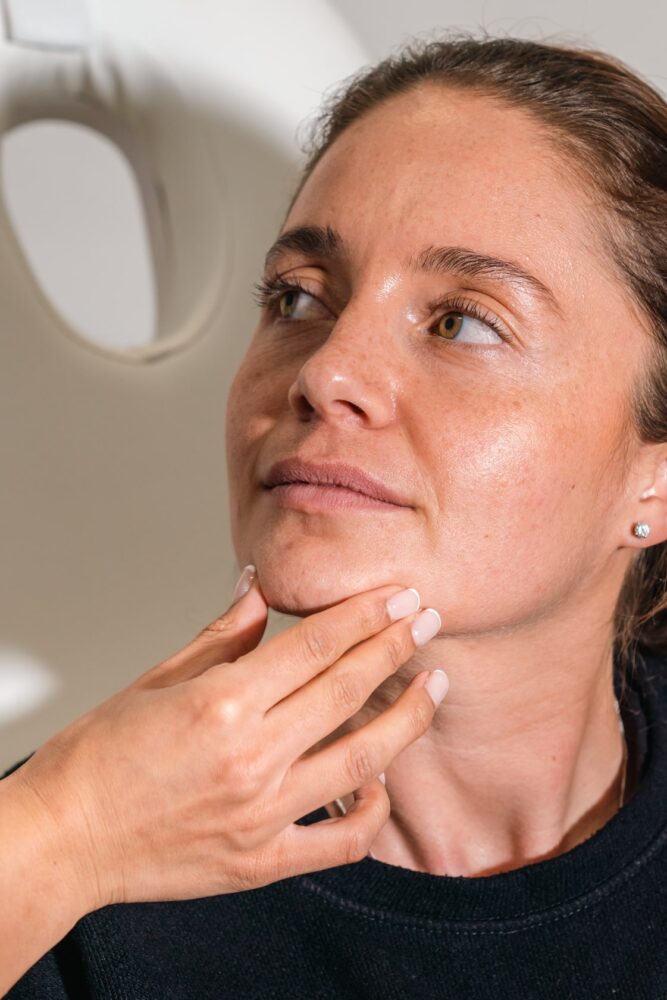 Skin Boosters