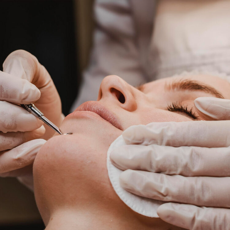 The Histology of Texture: Addressing Post-inflammatory Hyperpigmentation and Scarring through Controlled Dermal Remodelling