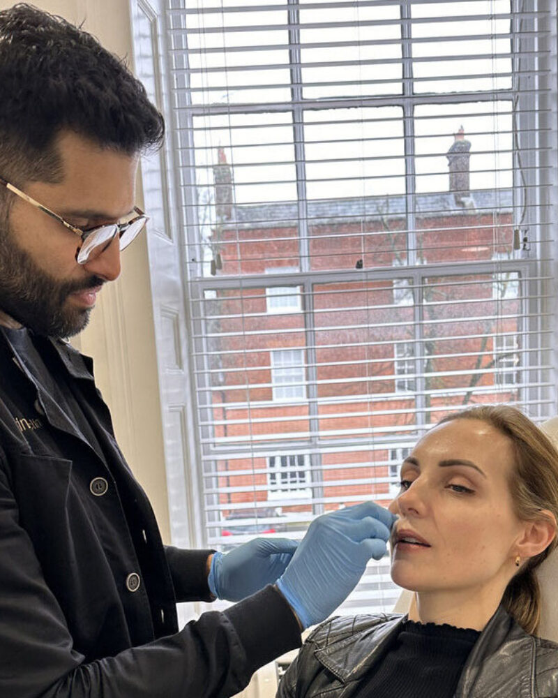 How Botulinum Toxin Works: The Neuromuscular Mechanism