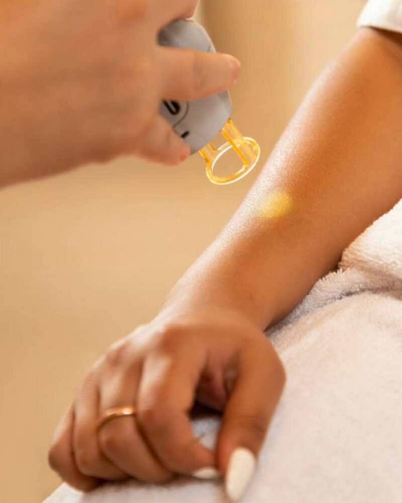 Benign vs Suspicious Moles: What to Know