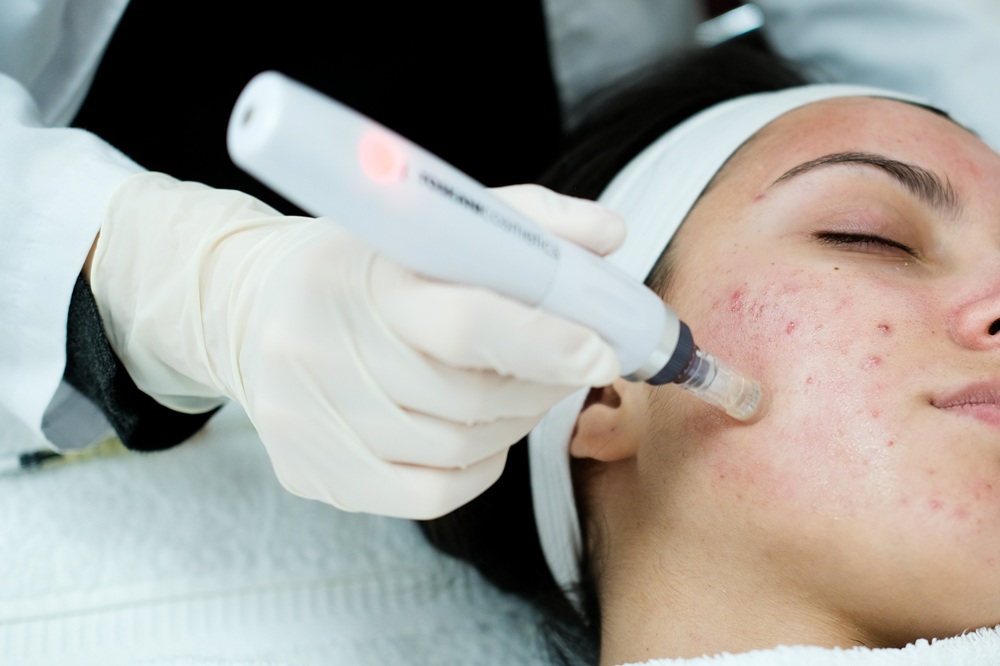Microneedling tools