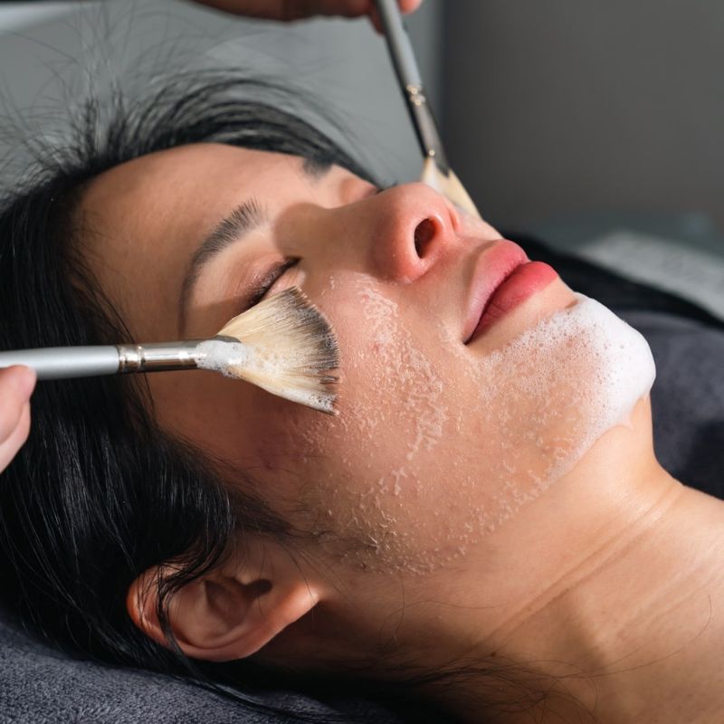 Enerpeel treatment