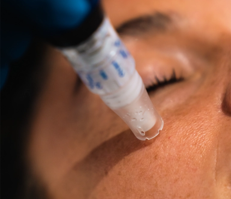 image-83-768x663.png Advanced Facials
