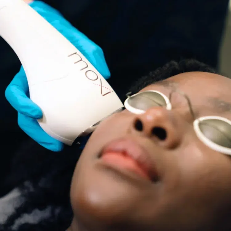 Laser Resurfacing Ascot: Refined Skin For Life’s Finest Moments