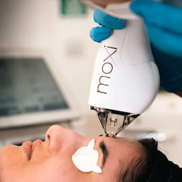 Laser Resurfacing High Wycombe: Your Local Solution For Long-Term Skin Confidence
