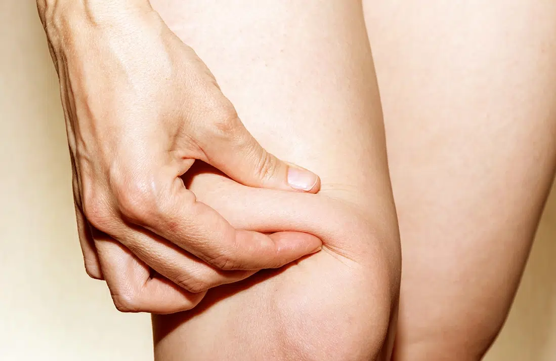img-40.jpg Knee Fat