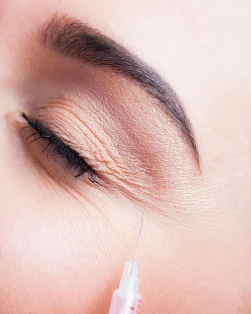 Facial Anatomy Basics for Patients