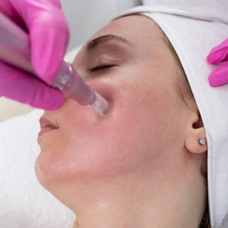 How Microneedling Triggers Collagen Induction