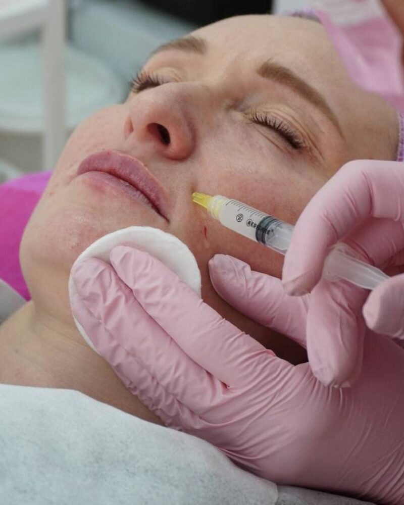 What Is Natural-Looking Botox?
