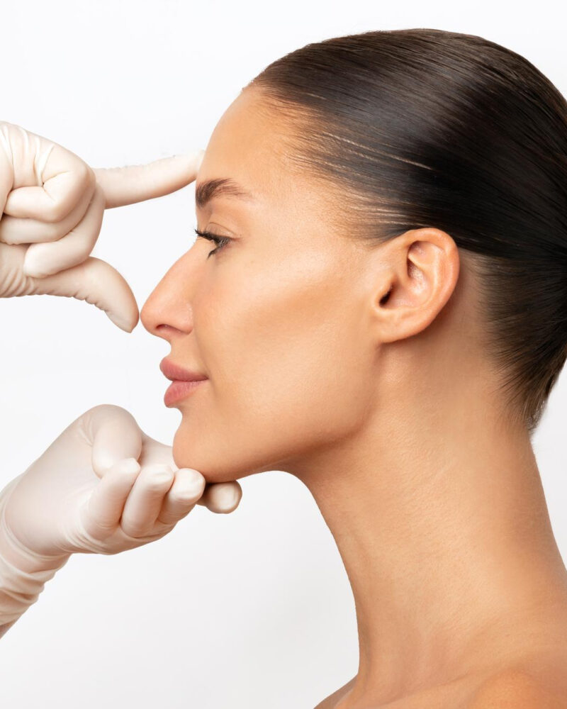 Non-Surgical Rhinoplasty in London: A Complete Guide